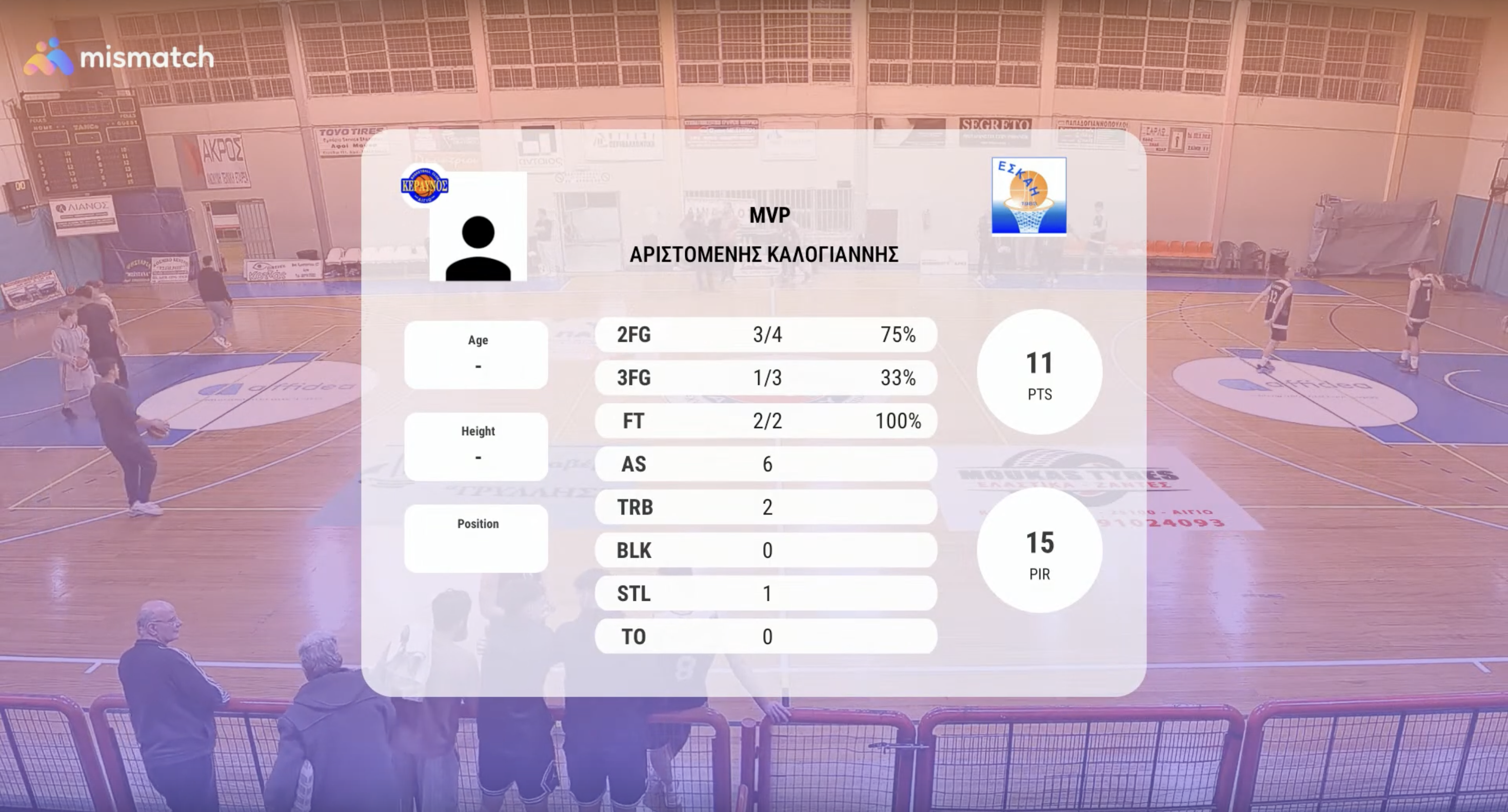 MVP display
